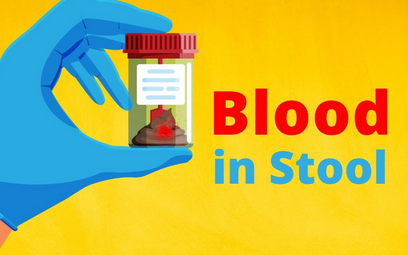 أعراض مصاحبة للإسهال تتطلب الانتباه